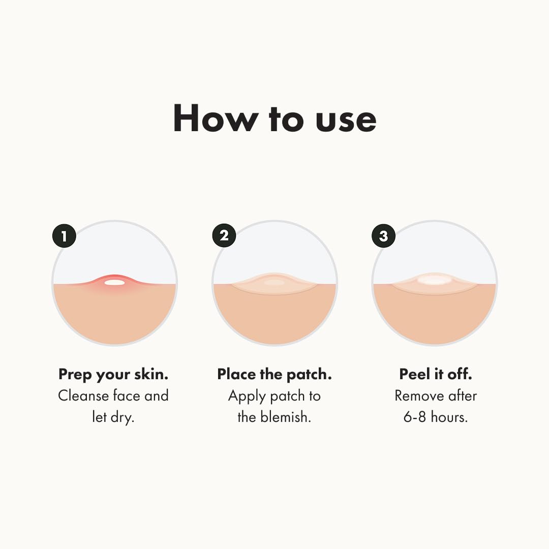β’ Original Patch from Hero Cosmetics β the #1 Hydrocolloid Acne Pimple Patch for Shrinking Zits and Whiteheads in 1 Use; Nighttime Spot Stickers for Face and Skin (36 Count)