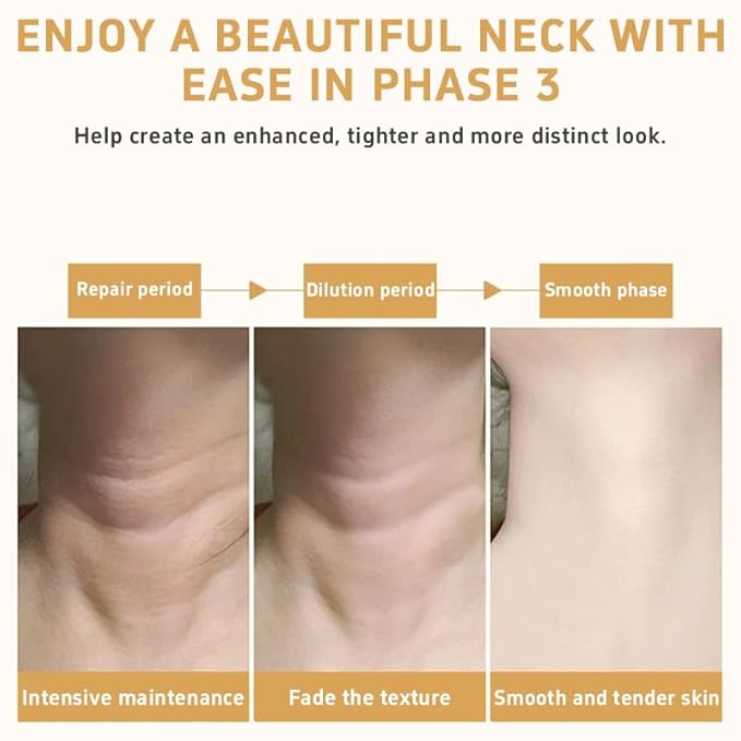 Champagne Lift & Firming Body Cream – Anti-Aging Skin Tightening Cream with Luxe-Lift Complex | Hydrates Dry Skin, Fights Crepey Skin on Arms & Legs (Sweet Almond Coconut)