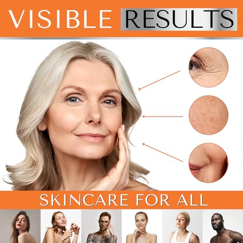 VITAMIN C SERUM FOR FACE – Hyperpigmentation Treatment, Dark Spot Corrector, Anti Wrinkle & Skin Brightening with Niacinamide, Hyaluronic Acid & Glycerin for Skin – Hydrating Glow Serum by DERMAWORKS