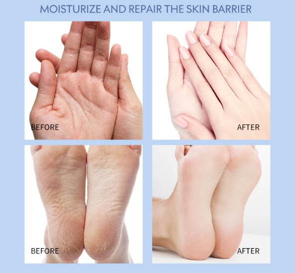 Lexenic Crack Feet Prevention Stick, Foot Cream for Dry Cracked Heels and Feet, Foot Care Cream, Moisturizing | Softening | Nourishing for Body, Hand, Foot 2Pcs Set