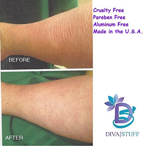 Extreme Crepey Skin Body & Face Cream With Hyaluronic Acid, Alpha Hydroxy and More, by Diva Stuff (Frosted Lime Cupcake)