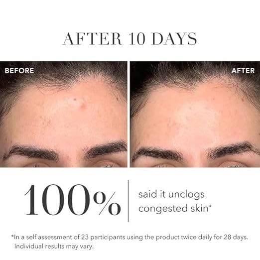 Algenist GENIUS Liquid Skin Resurfacing 2% BHA Toner - Facial Exfoliator for Fine Lines and Wrinkles - Collagen for Skin & Pore Refining Toner (100ml)