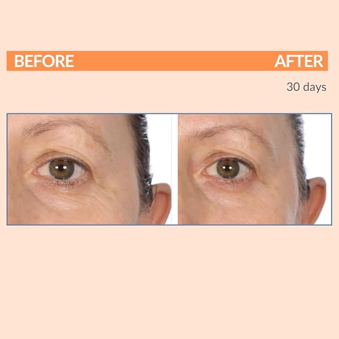 Serious Skincare Serious-C3 Plasma Vitamin C Day Trio - C Cream Daytime Moisturizer SPF 30 2 oz, Vitamin C Serum Skin Conditioner 1 oz. and C-Eye Treatment 0.5 oz.- For Smooth Radiant Skin