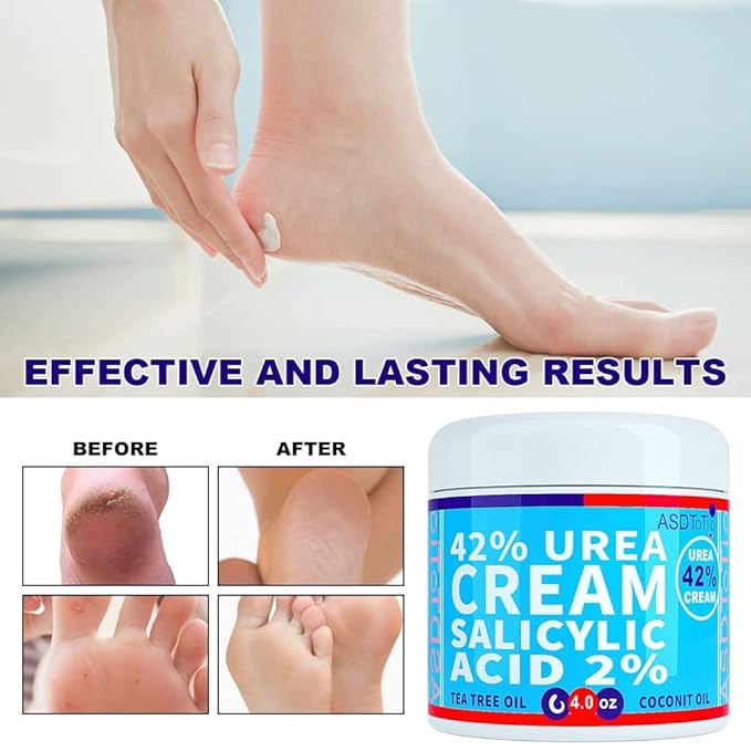Urea Cream 42% - Premium Urea Foot Cream - With 2% Salicylic Acid, Tea Tree Oil, Shea Butter, Aloe Vera - For Feet, Hands, Heels, Elbows, Knees and More - 8 oz