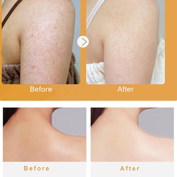 Turmeric Vitamin C Butt Body Scrub Exfoliator for Black Pore Deep Cleaning, Butt Acne/Back Excess Sebum/Oil/Inner Thigh/Elbow/Foot Dead Skin Cell/Ingrown Hair, Body Care-7.06 OZ
