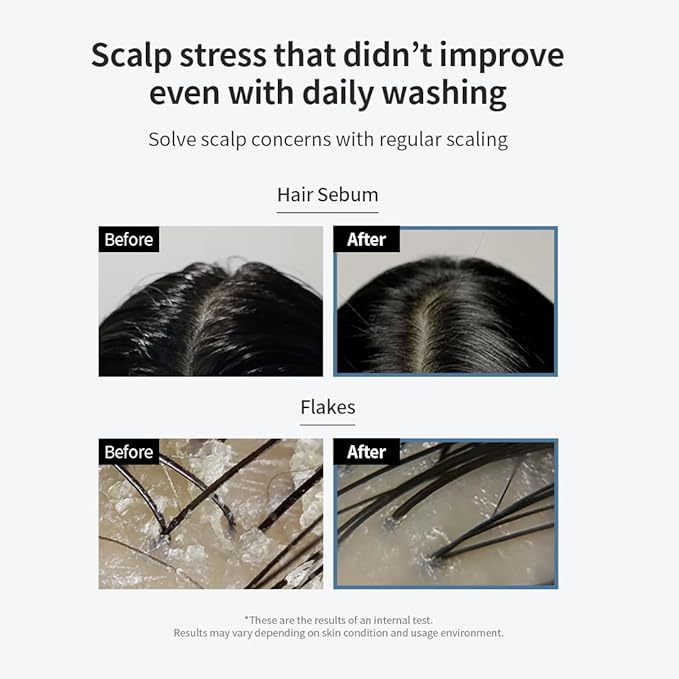 GROWUS Sea Salt Therapy Scalp Scaler - Salicylic Acid, Niacinamide, Dexpanthenol, Exfoliating, Deep Cleansing, Free from Paraben and Sulfate, 2 in 1 Type for Itchy and Oily Scalp (4.23 Oz / 120g)