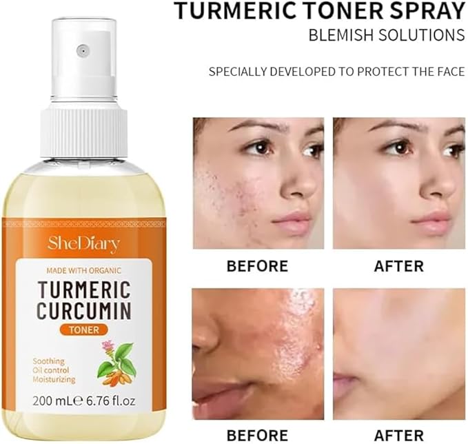 Turmeric Toner Spray Calming Hydrating Soothing Oil Control Moisturizing Face Mist (2)