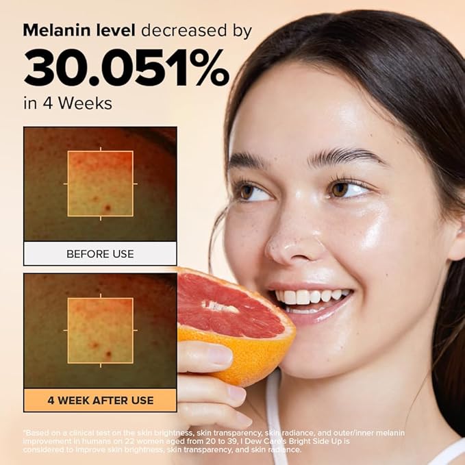I DEW CARE Vitamin C Face Serum - Bright Side Up | Hydrating with Niacinamide, Korean Glass Skin Care, Facial Treatment, Non-irritating, Lightweight, Exfoliating, 1.01 FL Oz