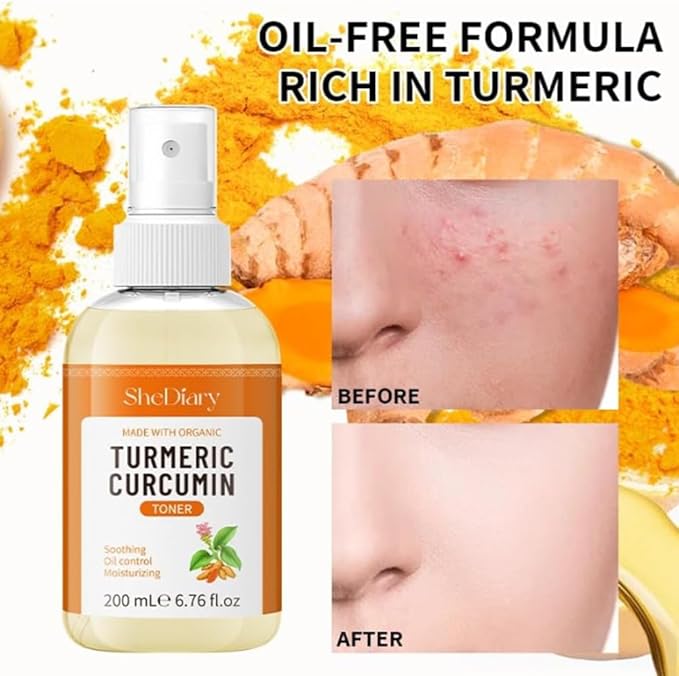 Turmeric Toner Spray Calming Hydrating Soothing Oil Control Moisturizing Face Mist (2)
