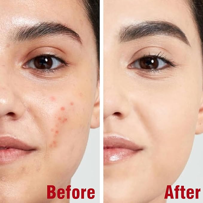 Turmeric Face Oil | Natural Glow Turmeric Facial Oil for Anti-Aging & Antioxidant, Tea Tree Oil with Aloe Vera + Witch Hazel + Jojoba, Lightweight Serum for Sensitive Skin & All Skin