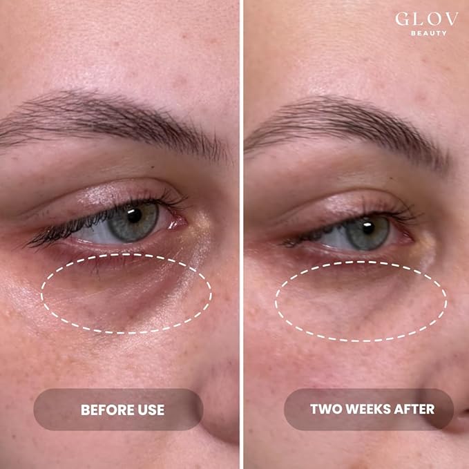Hydrate & Brighten Eye Cream - Anti-Aging Under Eye Cream for Dark Circles, Wrinkles & Puffiness - With Retinyl Palmitate, Sodium Hyaluronate & Niacinamide - All Skin Types