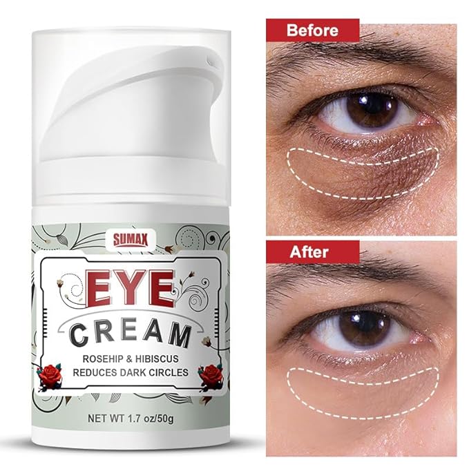 Eye Repair Cream, Rosehip & Hibiscus Eye Cream for Dark Circles, Puffiness, Wrinkles and Bags, Reduce Fine Lines for Sensitive Skin - 1.7 OZ