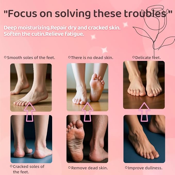 Gel Socks for Dry Cracked Feet Women,Foot Moisturizing Socks,Gel Socks Spa Socks,Cotton Socks for Moisturizing Feet Overnight