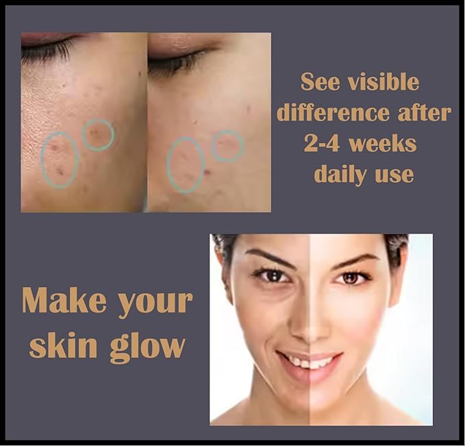 Vitamin C Serum, 20% L-Ascorbic Acid, with Hyaluronic Acid, Ferulic Acid, Vitamin E, 30ml