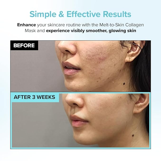 Melt to Skin Collagen Mask, – Wrinkle Patches for Forehead, Eyes & Smile Lines - Frown Lines, Eleven-Lines Repair Patches, Invisible Face Wrinkles Smoothers - Korean Skin Care, 4EA