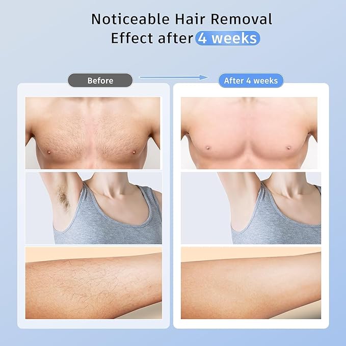 Laser Hair Removal with 5℃ Ice Cooling, Painless IPL Laser Hair Removal Device 3 in 1 Ubroo at Home Hair Remover Machine for Women Men Electrolysis Permanent Epilator on Face Body Depilation (Purple)
