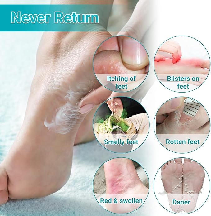 Athletes Foot Treatment Cream, Maximum Strength for Athlete's Foot (Tinea Pedis), Itching, Blister, Burning, Cracking, Scaling, Beriberi,Natural Herbs Antifungal Foot Cream
