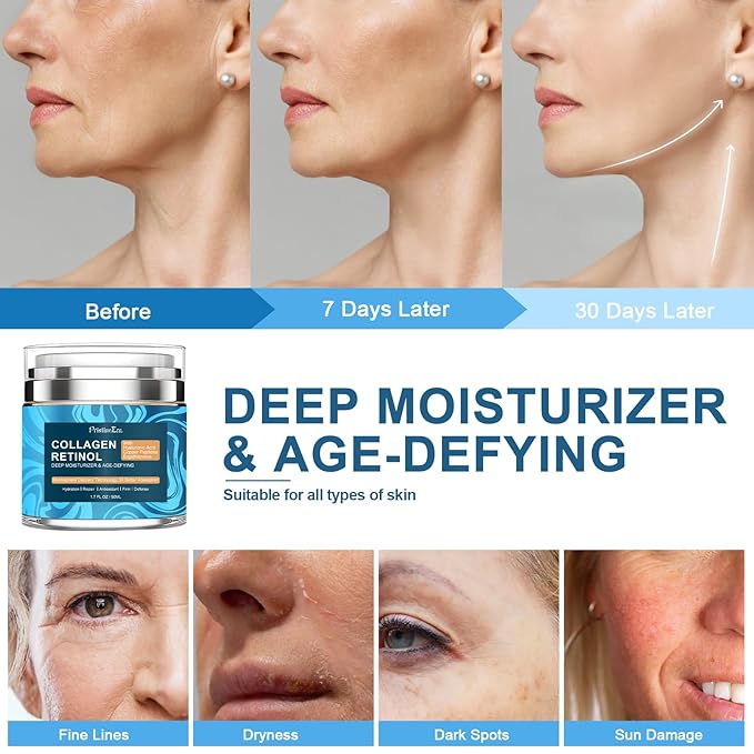 Collagen Retinol Hyaluronic Acid Cream, Anti-Aging Face Moisturizer for Face, Firming Skin Care Neck & Décolleté, Daily Moisturizer Face Cream Day & Night - 1.7 fl.oz.