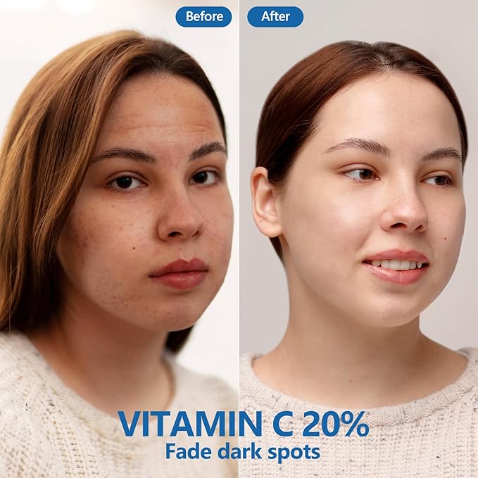 20% Vitamin C Serum for Face Care with Hyaluronic Acid,Boost Radiance & Reduce Wrinkles, Improve Appearance of Dark Spots,Fine Lines & Wrinkles,for Normal or Oily Skin Control -2 Pack