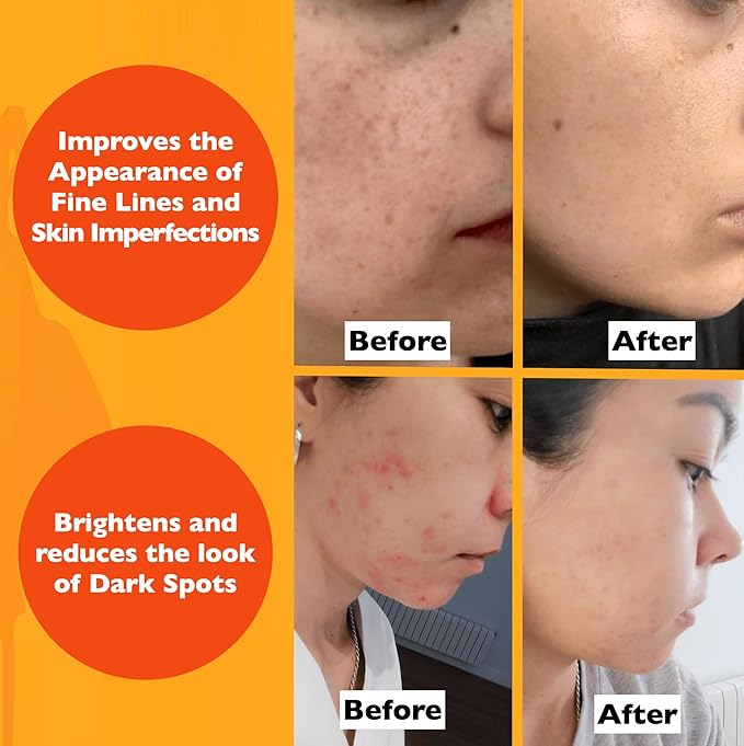 Vitamin C Serum For Face β Anti-Aging Facial Serum with Vitamin C, Hyaluronic Acid, Niacinamide, B5 & Vit E. Brightening Facial Essence for Dark Spots, Fine Lines, Wrinkles & Glowing Skin, 2 Fl Oz