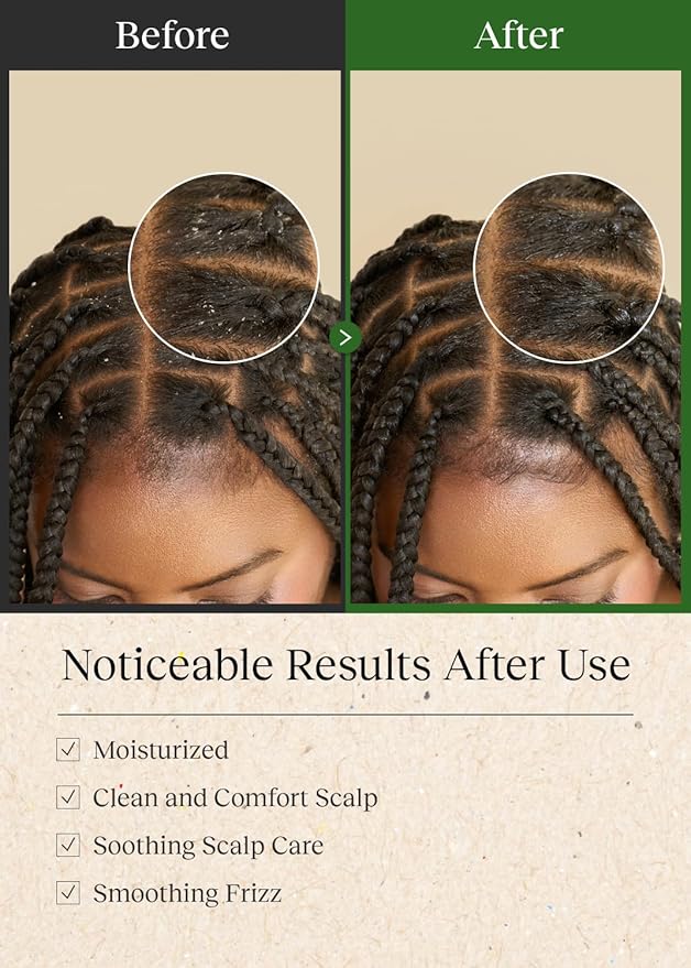 Scalp Cleansing Toner with Apple Cider Vinegar for Braiding Hair, No-Rinse Moisturizing Scalp Exfoliator, 6.76 Fl Oz