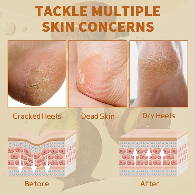Heel Moisturizing Balm Stick Cracked Foot Nourishing Repair for Rough Dry Chapped Feet Hands Heels Nails Elbows with Shea Butter & Olive Vitamin E Natural Mild Moisturizer 1.41Oz (Shea Scent)