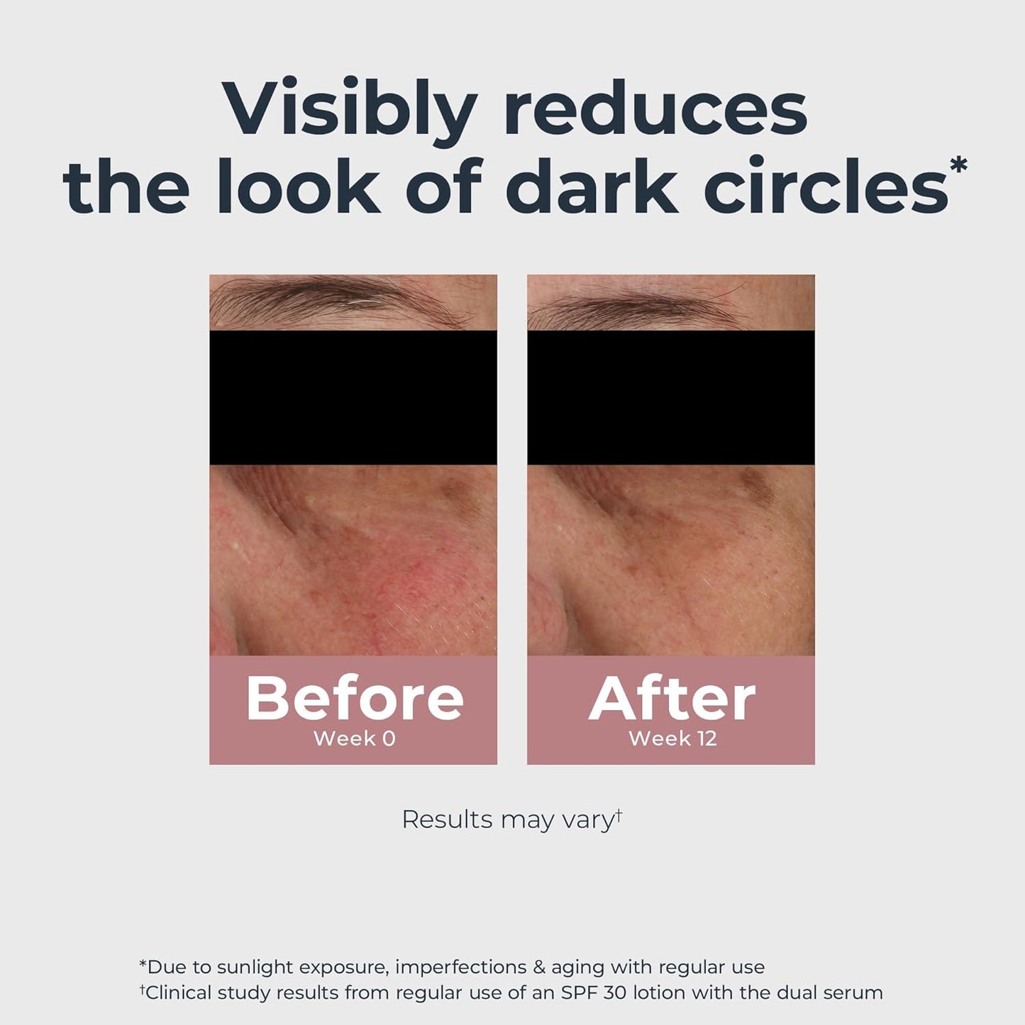 Radiant Tone Eye Cream β Dark Circle Corrector, 0.5 oz ποΈβ¨