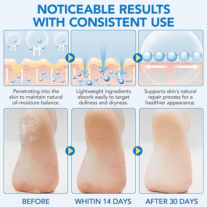 Urea Foot Care Stick, 60% Urea with 2% Salicylic Acid Foot Cream Moisturizer for Dry Cracked Feet, Knees, Elbows, Hands, Moisturizes and Hydrates the Dry Skin, Callus Remover & Skin Softener 1.41 oz