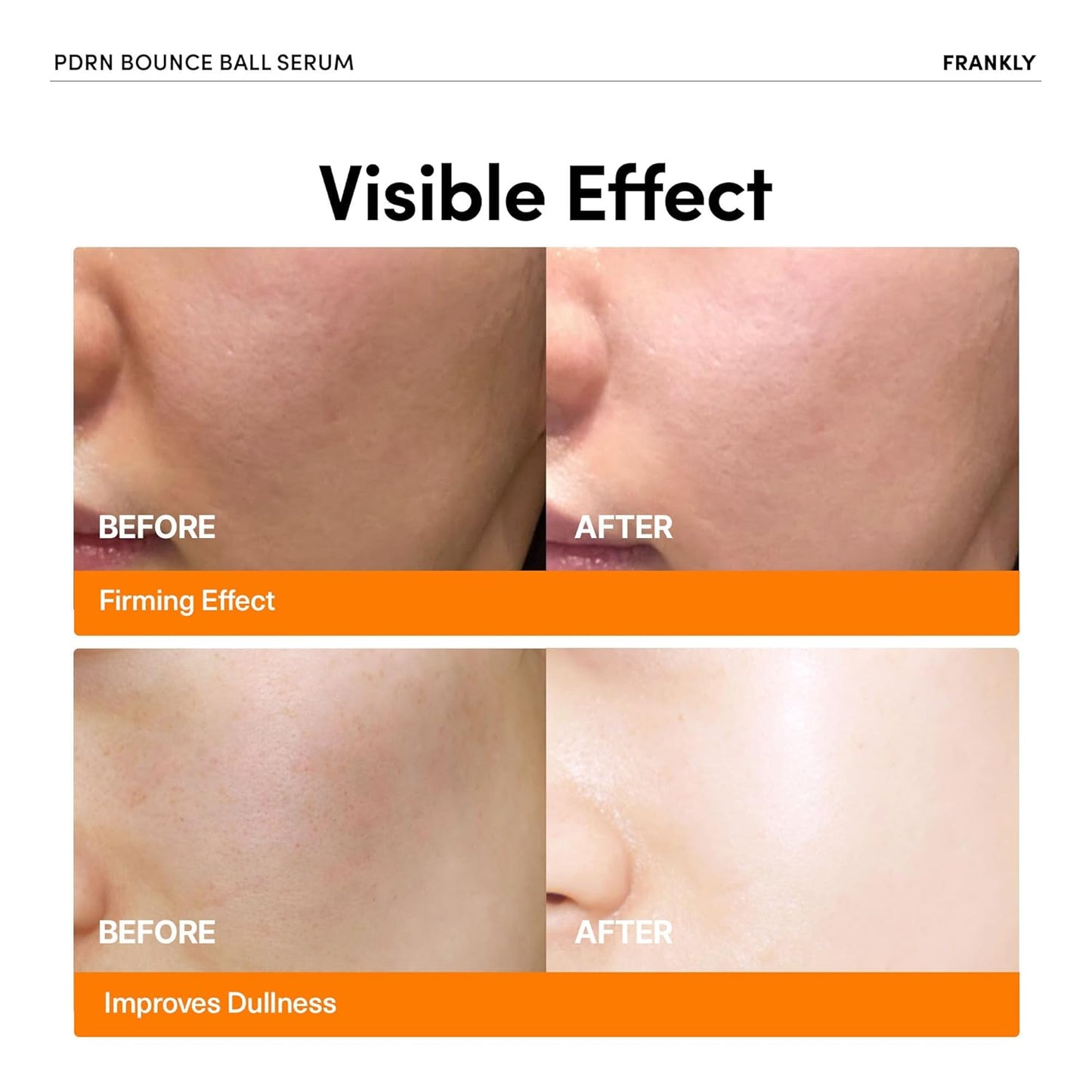 PDRN Bounce Ball Serum – Korean Salmon DNA Face Serum for Glass Skin, Plumping & Firming – Lightweight, Non-Sticky Glow Serum for Bouncy, Hydrated Skin – 1.01 Fl Oz