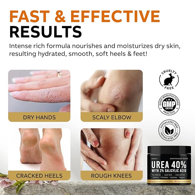 Urea Cream 40 Percent for Feet Maximum Strength, Urea Foot Cream for Dry Cracked Heels Feet Knees Elbows, 40% Urea Foot Repair Lotion 5.3 OZ