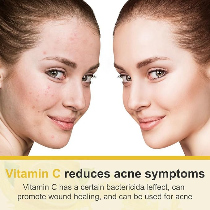 Vitamin C Face Cream With Nicotinamide & Hyaluronic Acid, Anti Aging Moisturizer For Reducing Wrinkles, Fine Lines & Tightening Skin