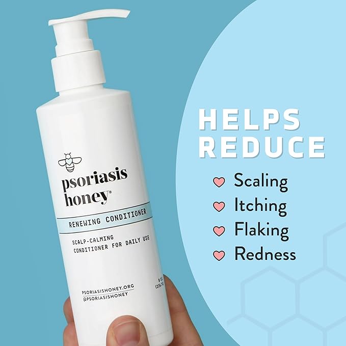 Renewing Conditioner - Dry Scalp Treatment - Psoriasis Cream for Dry Hair - Coconut Oil Hair Moisturizer Helps Relieve Symptoms of Eczema, Dandruff, Dermatitis & More (8oz)