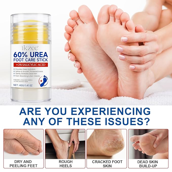 Urea Cream Stick 60% plus 2% Salicylic Acid, Urea Foot Cream for Dry Cracked Heels, Foot Lotion Stick for Rough Thick Dry & Cracked Skin, Maximum Strength Moisturizer,Softening Skin Moisturizer Lotion