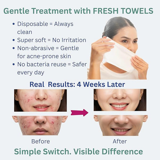 FRESH TOWELS Disposable Face Towels, Makeup Removal Face Towelettes & Dry Wipes, 300 Ct, 6 Packs