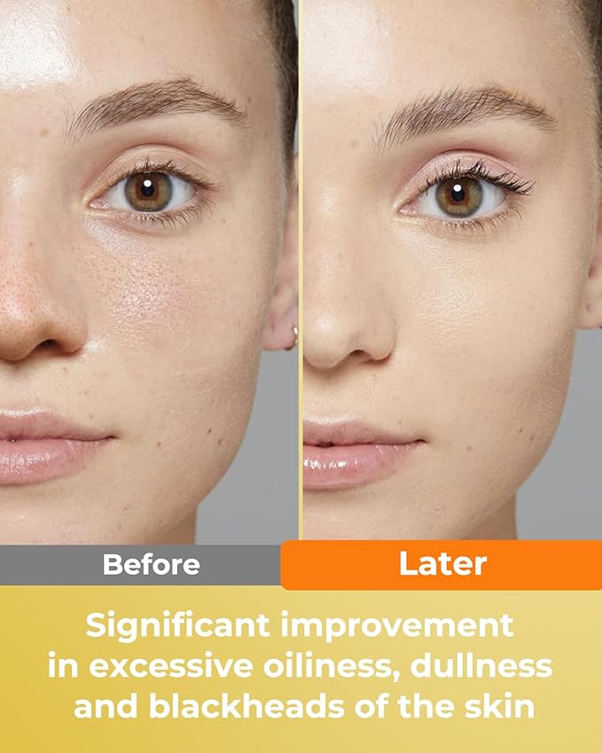 Turmeric and Kojic Acid Cleansing Face Pads – Turmeric Exfoliating Face Scrub Pads, 50 Pcs, for Mild Cleansing Exfoliation Oil Control, Suitable for All Skin Types