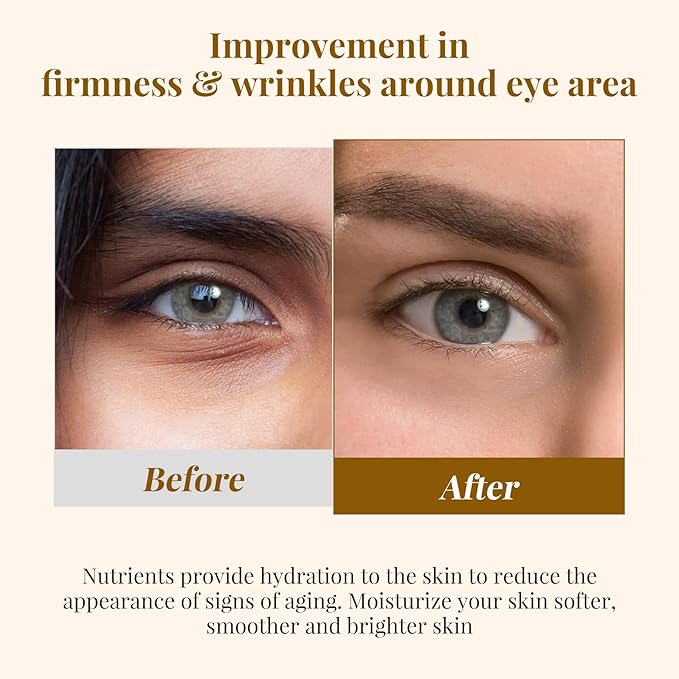 EJW Revive Eye Serum with Gentle Retinoid Correction for Under Eye Bags Wrinkles Puffiness, Fine Lines and Crows Feet, Hydrating & Firming Anti-Aging, Elevates Radiance and Revives Skin, 0.5 oz