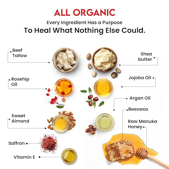 Whipped Tallow Balm with Raw Manuka Honey – Fragrance-Free & Essential Oil-Free, Anti-Aging Face, Neck & Décolleté Cream – Boosts Collagen, Reduces Wrinkles, Fine Lines, Puffiness & Sunburn (2 oz)