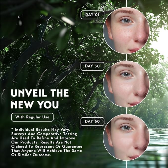 O NATURALS 100% Natural Bar Kojic Acid Soap - Gift Set - Organic Ingredients & Essential Oils - Spa Gifts for Women & Men, Body Wash - 4PC Turmeric