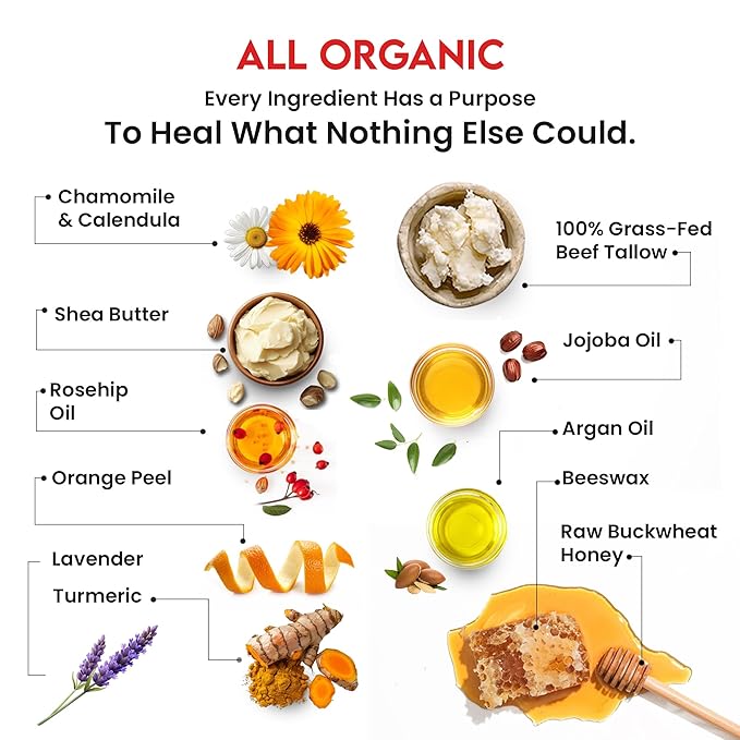 Whipped Tallow Balm Infused with Raw Buckwheat Honey, Lavender & Orange – Organic Anti-Inflammatory Cream for Face, Scalp & Body – Heals Sensitive, Acne-Prone, Eczema, Rosacea & Psoriasis Skin (2 oz)