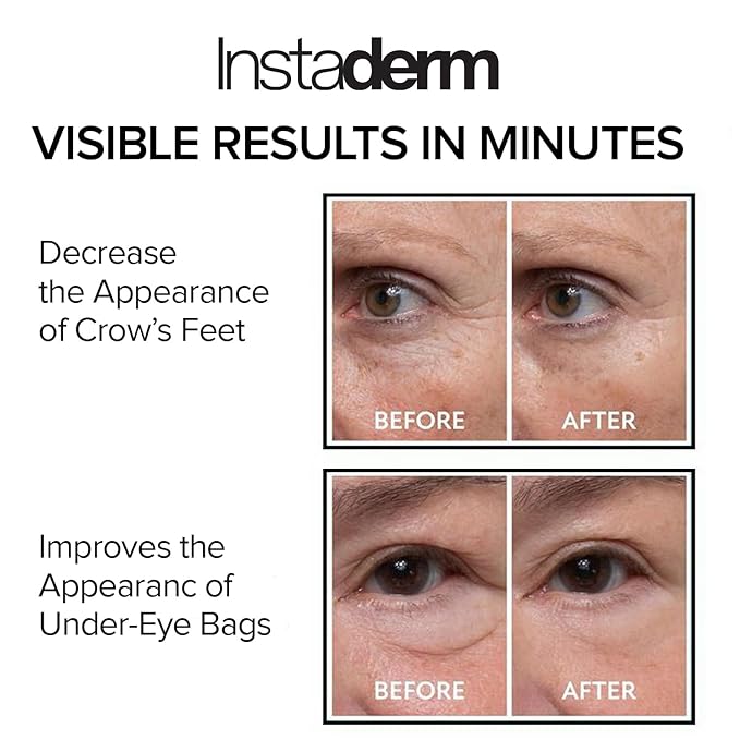 Instant Eye Tightener – Removes Under Eye Bags & Puffiness. Eliminate Dark Circles & Wrinkles. Naturally Ageless Hydrating Cream. Disappears Before Your Eyes Within Minutes.