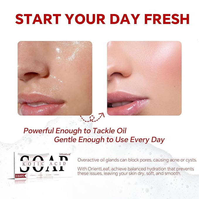 Kojic Acid Soap, Turmeric Soap Bar for Dark Spots, Fresh Citurs Scent, Gentle for Face and Body Wash with Vitamin C, Shea Butter, Retinol, Olive Oil, Collagen (3 PACK)