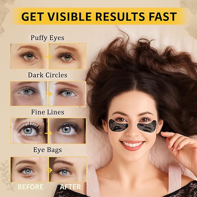 Under Eye Patches(24 Pairs),Lace Eye Mask for Puffy Eyes and Dark Circles,Collagen Skin Care Products,Hydrating, Smoothing, Brightening,Anti-Aging Eye Patch for Under Eye Bags