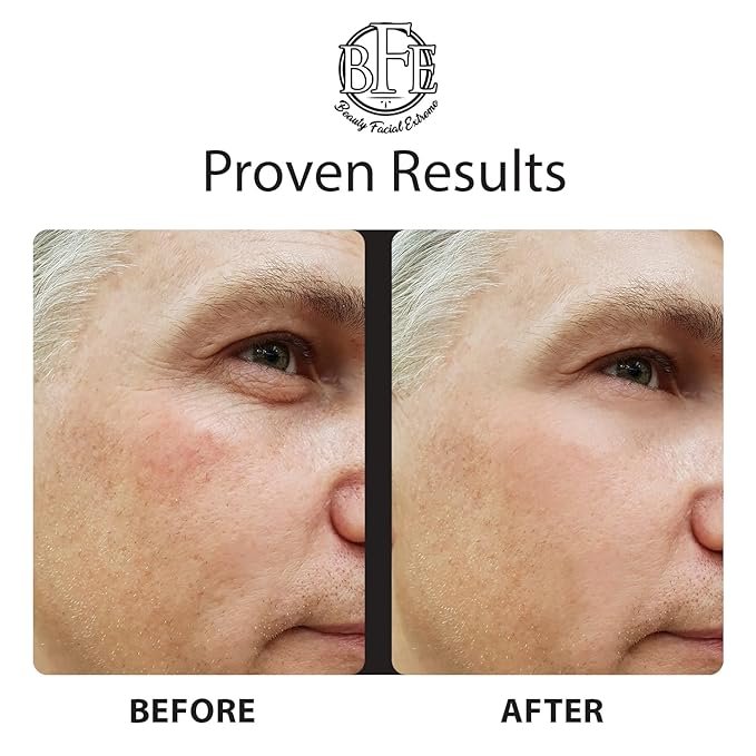 Instant Ageless Eye Cream - Reduces Under Eye Puffiness, Bags, Dark Circles. Lift Technology to Tighten & Firm Sagging Skin Around Eyes. Smooths Away Crow’s Feet, Fine Lines & Wrinkles for Men & Women