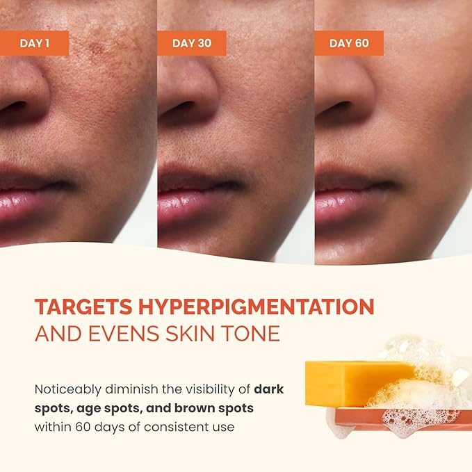 PLANTIFIQUE Kojic Acid Soap for Hyperpigmentation 3 Bars with African Net - Turmenic Soap with Hyaluronic Acid, Collagen, Vitamin C for Dark Spots - Vegan Skincare 240g / 8.47 oz
