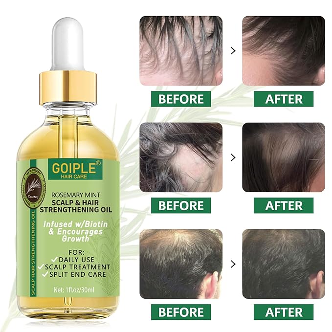 WOZUTUNT Rosemary Oil, 1 FL OZ - Natural Hair Growth Oil With Essential Oils, Nourishing Treatment for Split Ends, Dry Scalp, Hair Loss - Women's Hair Care