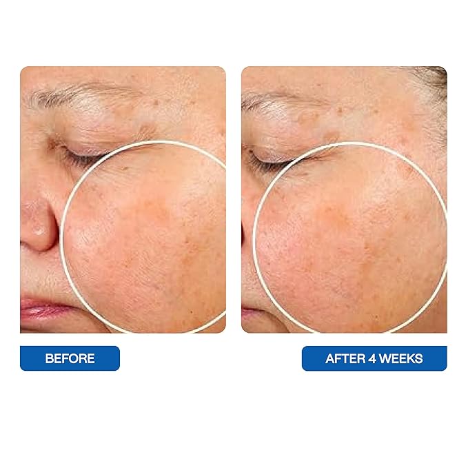 BeautyStat Universal Microbiome Barrier Repair Purifying Cleanser - Gentle Detoxifying Cleanser with Medical Grade MicroSilverBG to Protect Skin and Promote a Healthy, Radiant Glow (4oz /120ml)