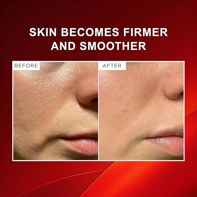 Red Booster Microneedling Serum for Face with Dragon’S Blood, Daily Hydrating, Plumping & Anti-Aging Serum Soft Skin, Glass Skin, Exfoliating, Lightweight, Korean Skin Booster 1.76 Fl.oz