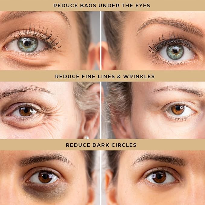 Temporary Eye Tightener Eye Cream, Instant Reduces Under-Eye Bags, Dark Circles&Puffiness, Anti Aging Fine Lines, Firm That Delicate Skin Under Your Eyes 0.5 oz - 2 pcs