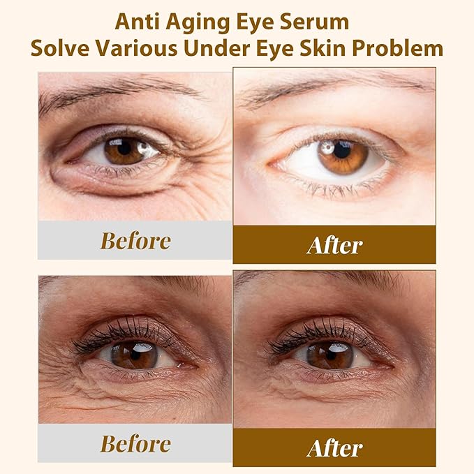 EJW Revive Eye Serum with Gentle Retinoid Correction for Under Eye Bags Wrinkles Puffiness, Fine Lines and Crows Feet, Hydrating & Firming Anti-Aging, Elevates Radiance and Revives Skin, 0.5 oz
