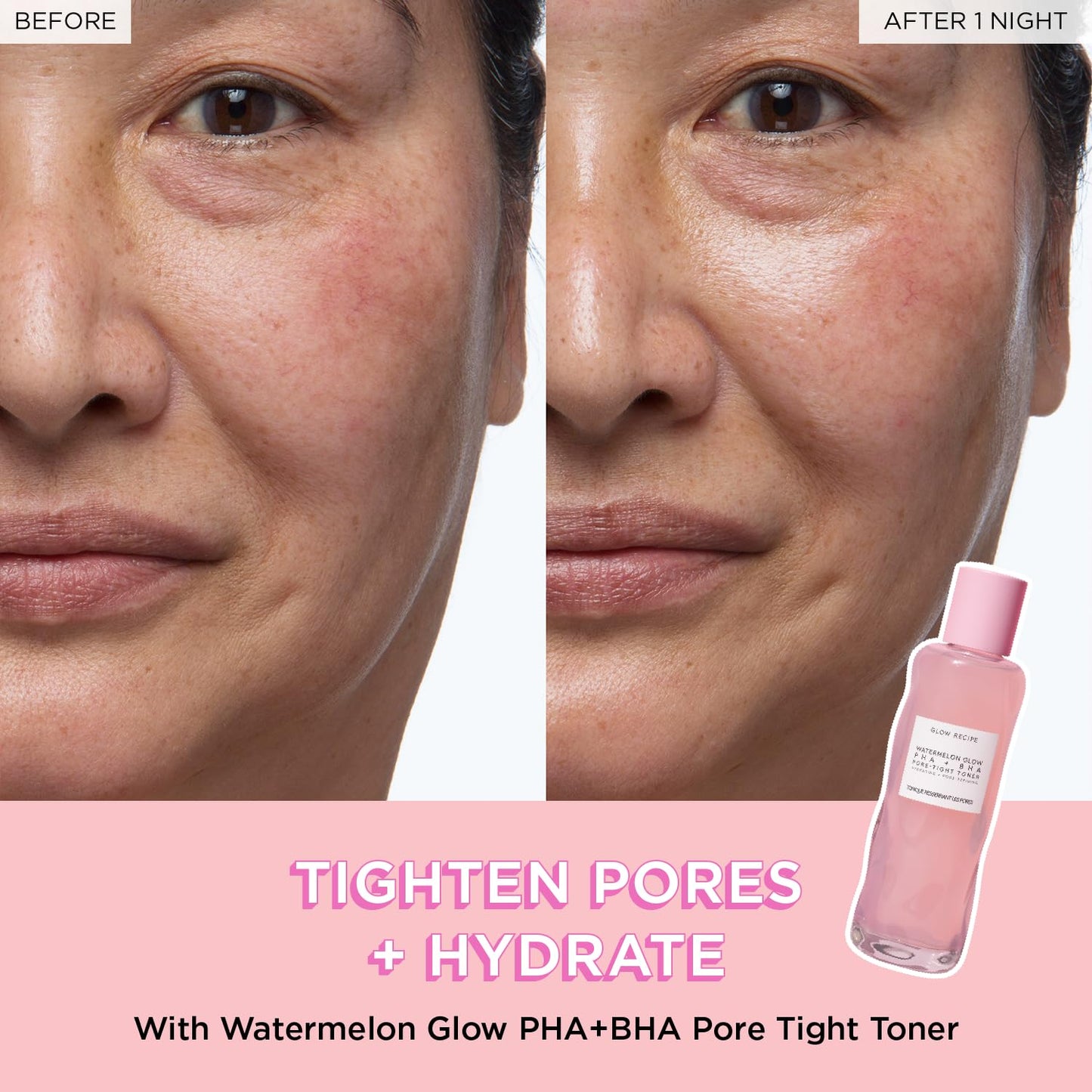 PHA + BHA Face Toner - Korean Skin Care Pore Minimizer & Gentle Facial Exfoliator for Tightening, Hydrating & Exfoliating - Glycerin, Watermelon & Cactus Water (150Ml)